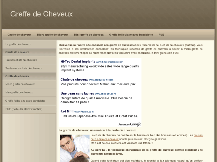 www.greffedecheveux.fr