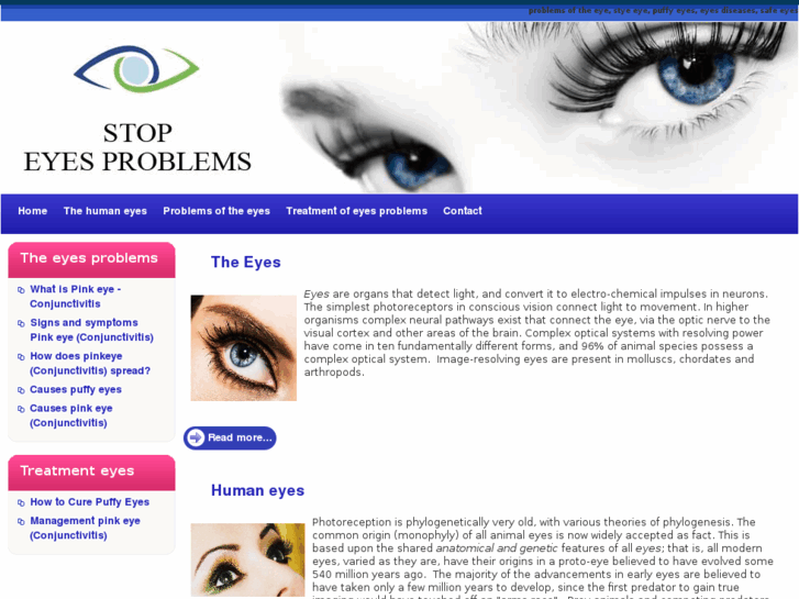 www.stopeyesproblems.com