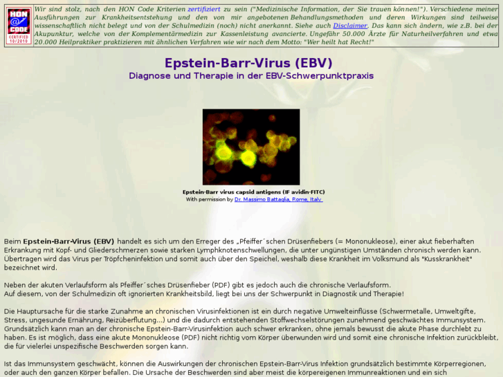 www.epstein-barr-virus-info.com