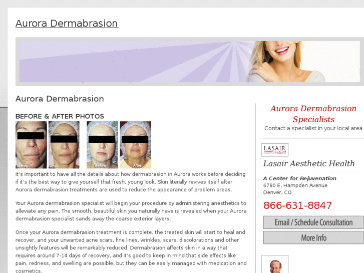 www.auroradermabrasion.com