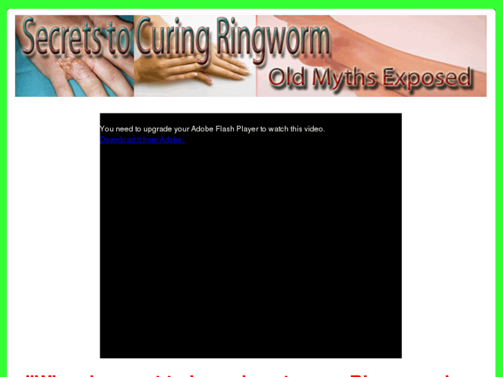 www.secretstocuringringworm.com