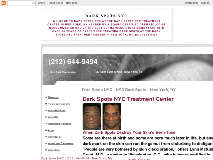 www.darkspotsnyc.org