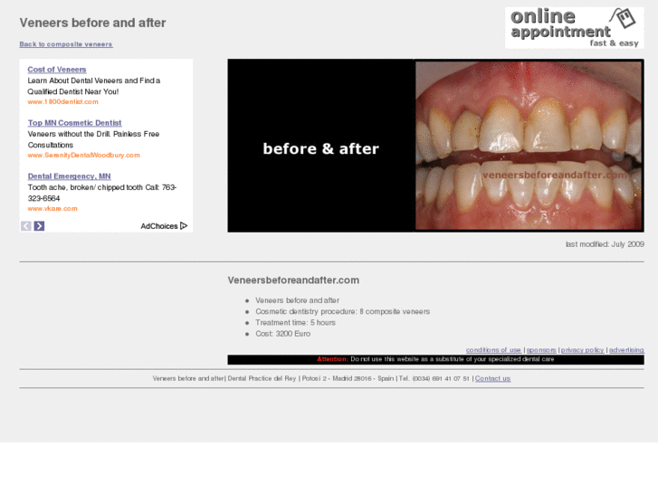 www.veneersbeforeandafter.com