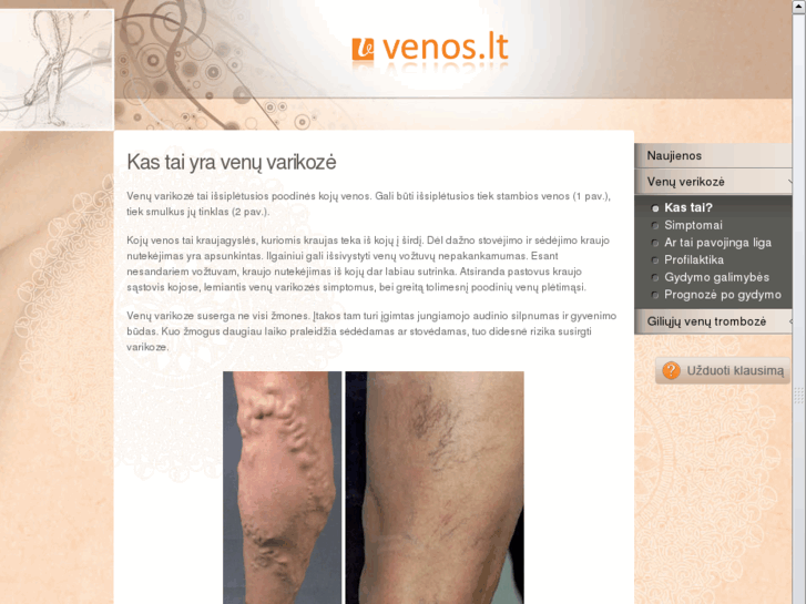 www.venos.lt