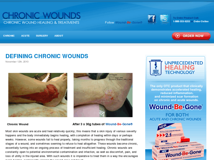 www.chronic-wounds.com