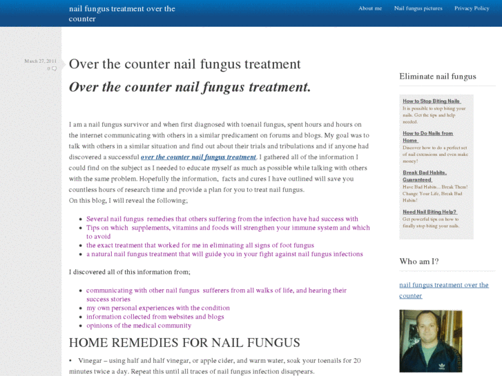 www.nailfungustreatmentoverthecounter.com