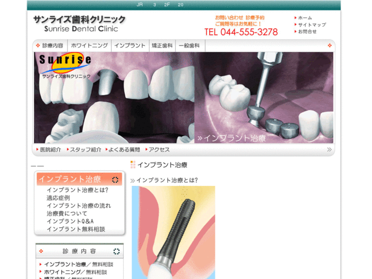 www.implant-sd.com