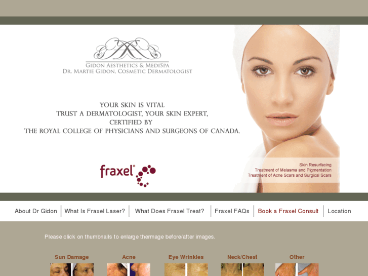 www.fraxelclinic.ca