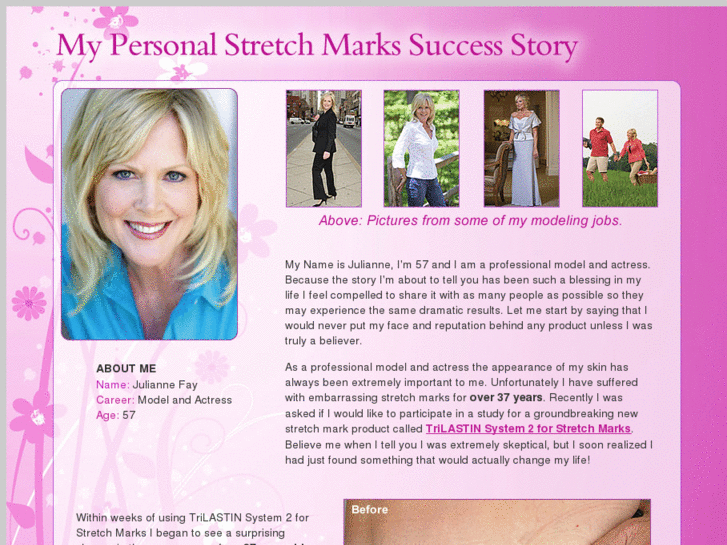 www.mystretchmarkstory.com