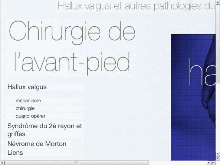 www.chirurgiedupied.com