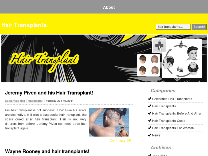 www.hairtransplantsforyou.com