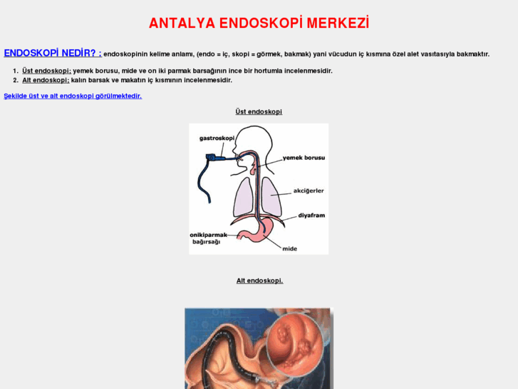 www.antalyaendoskopi.com