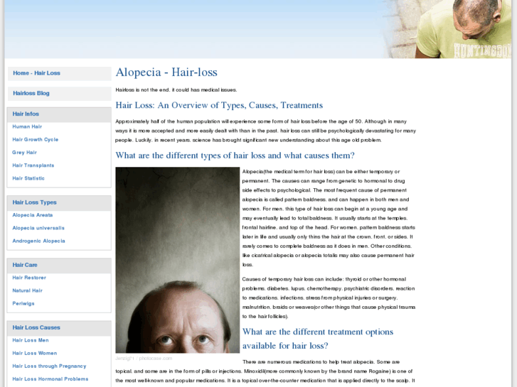 www.alopecia-hairloss.com