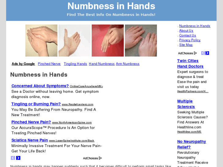 www.numbnessinhands.net