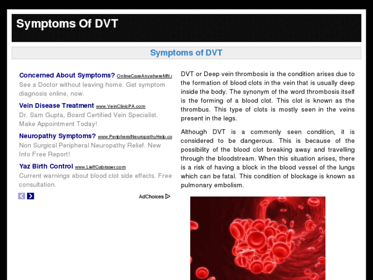 www.symptomsofdvt.net