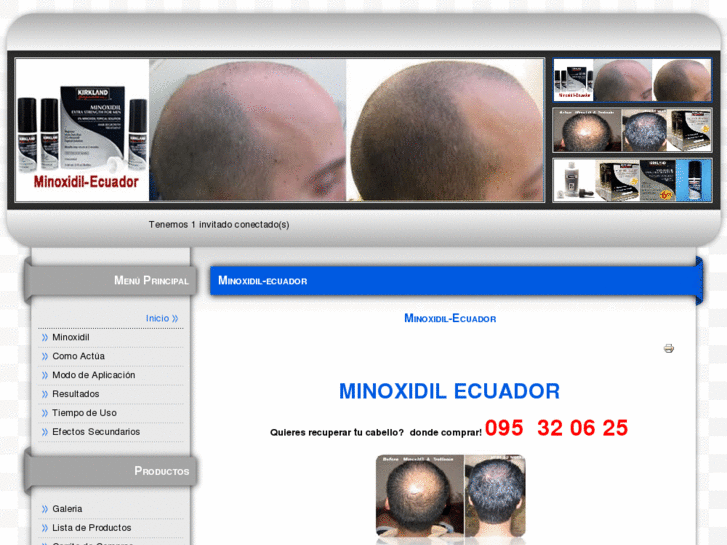 www.minoxidil-ecuador.com