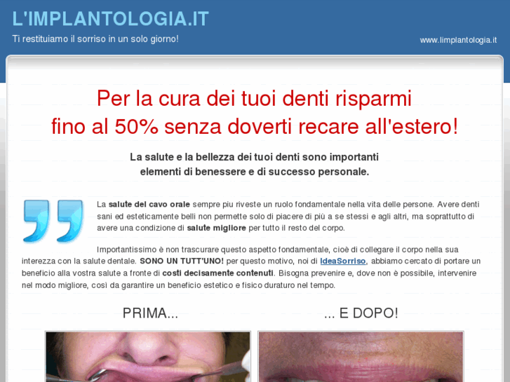 www.limplantologia.it