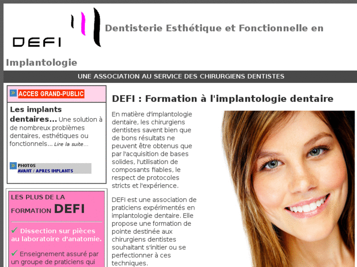 www.defi-implants.com