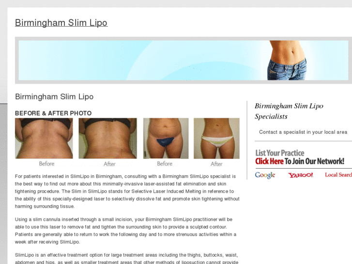 www.birminghamslimlipo.com