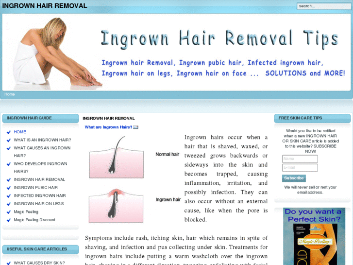 www.ingrownhair-removal.com