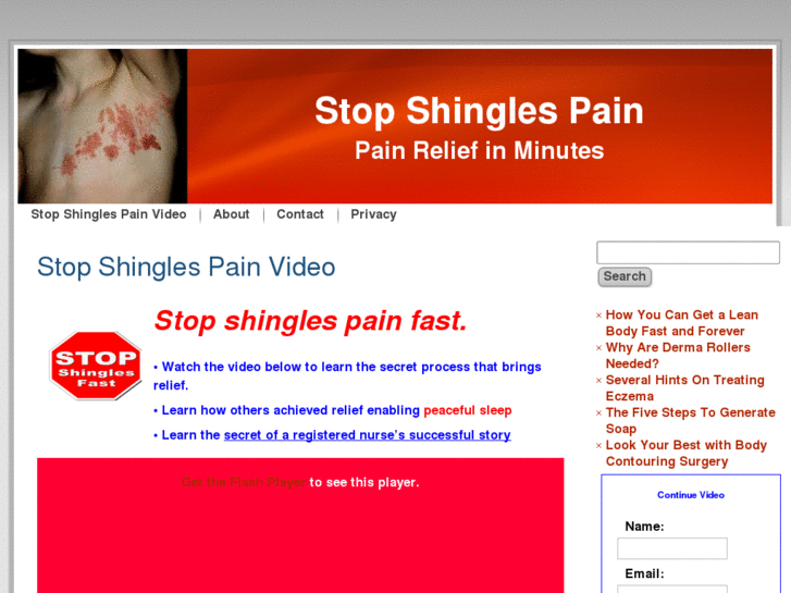 www.stop-shingles-pain.com