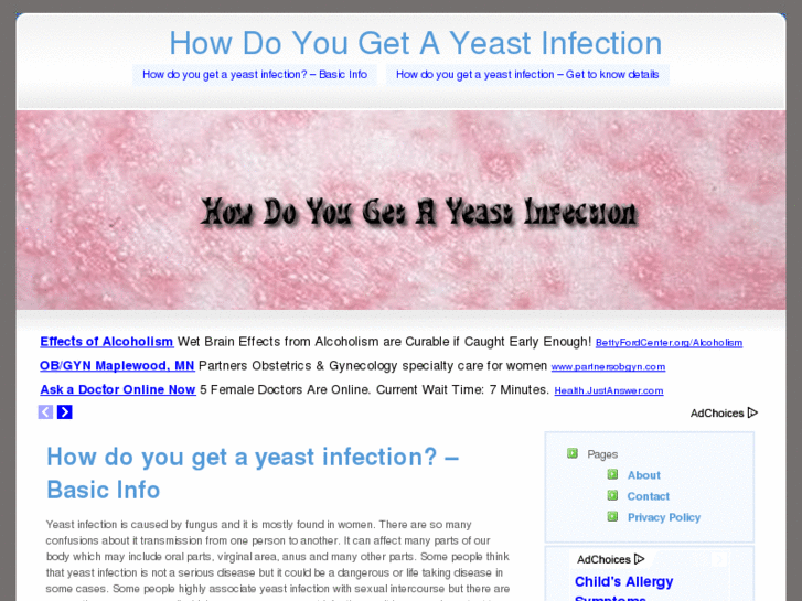 www.howdoyougetayeastinfection.com