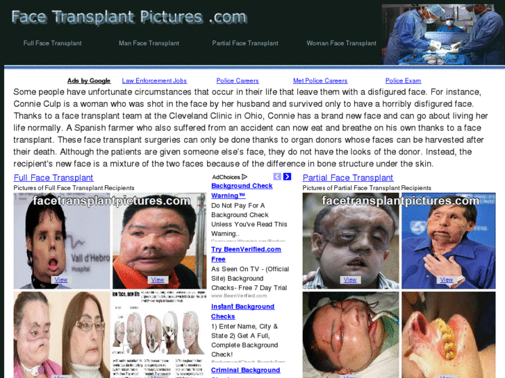 www.facetransplantpictures.com