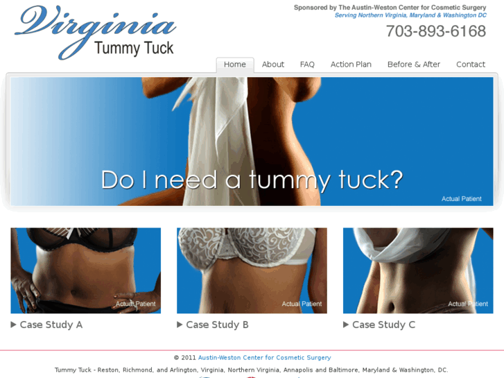 www.virginiatummytuck.com