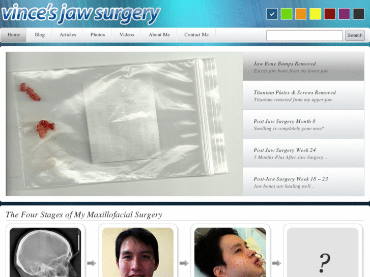 www.vincejawsurgery.com