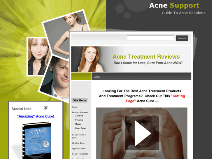 www.acne-support.com