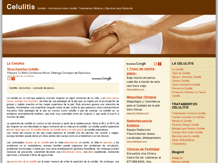 www.celulitis.org.es