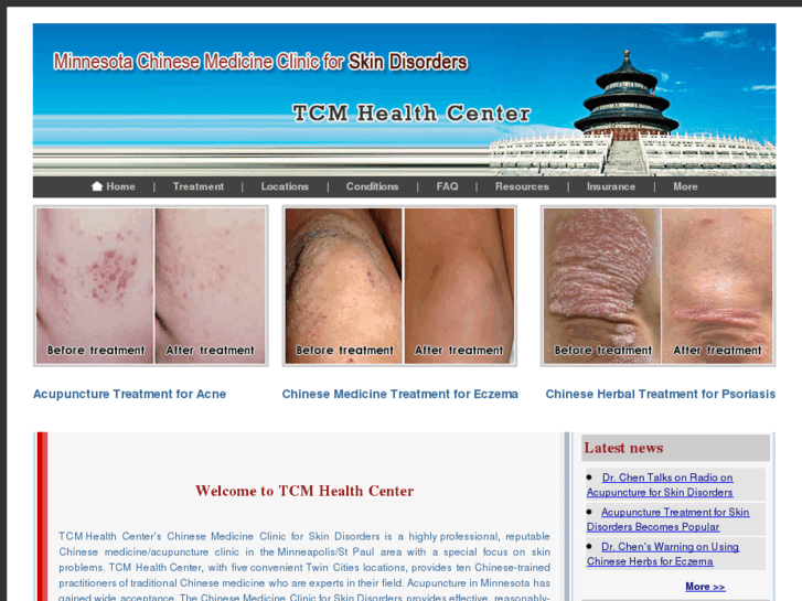 www.acupunctureforskin.com