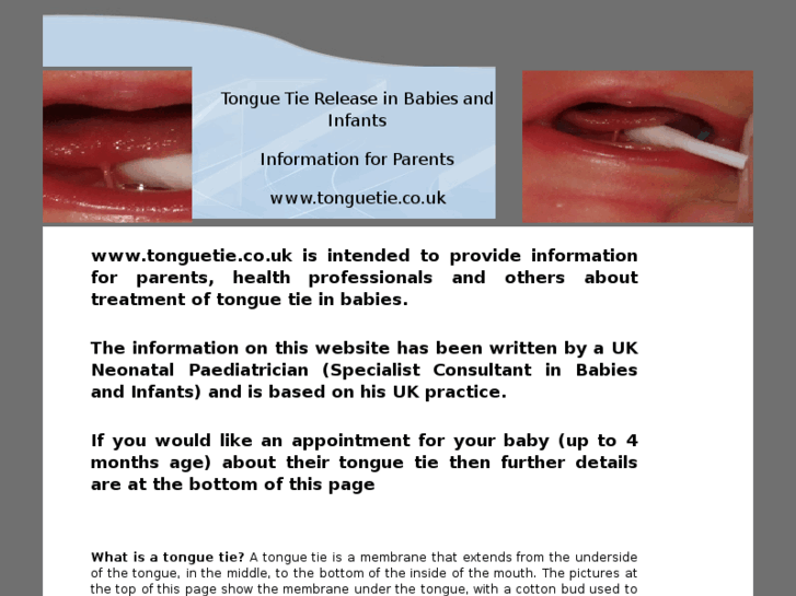 www.tonguetie.org