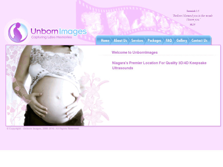 www.unbornimages.com