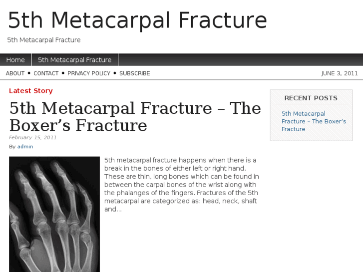 www.5thmetacarpalfracture.com