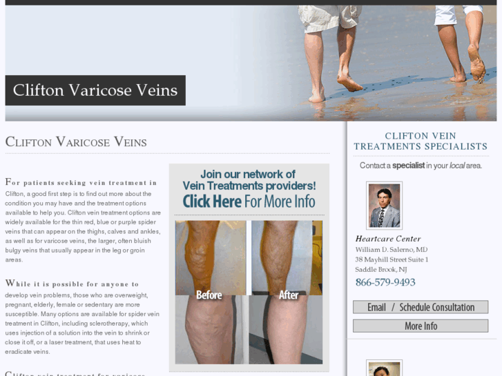 www.cliftonvaricoseveins.com