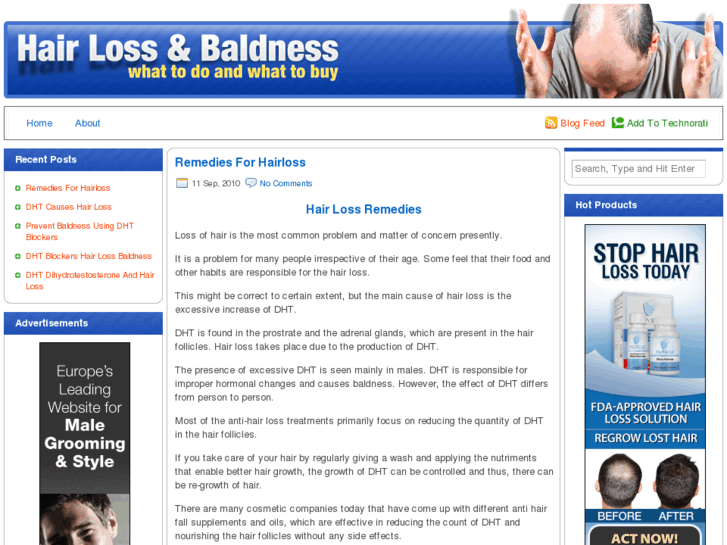 www.hairlossandbaldness.co.uk