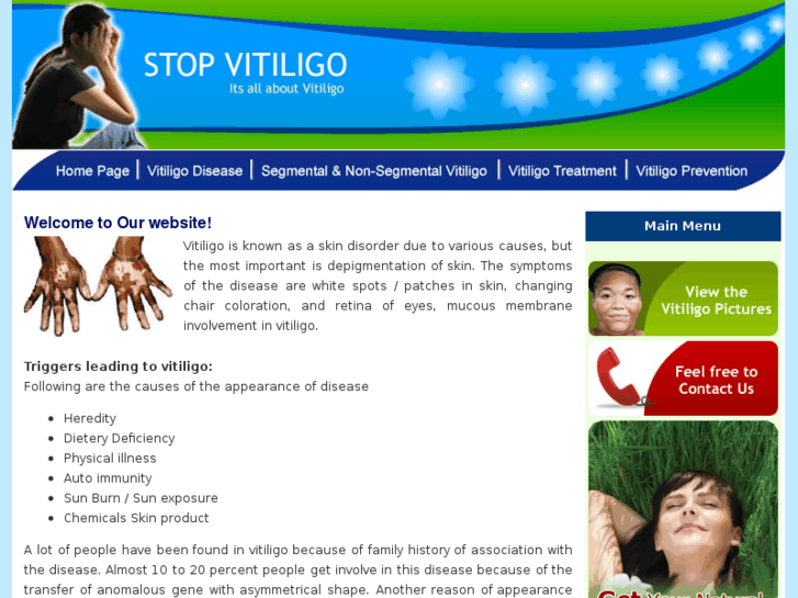 www.stopvitiligo.com