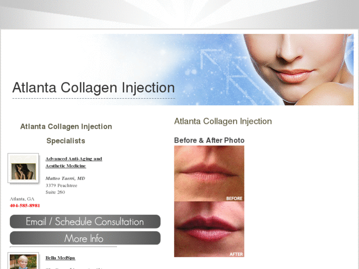 www.atlantacollageninjection.com