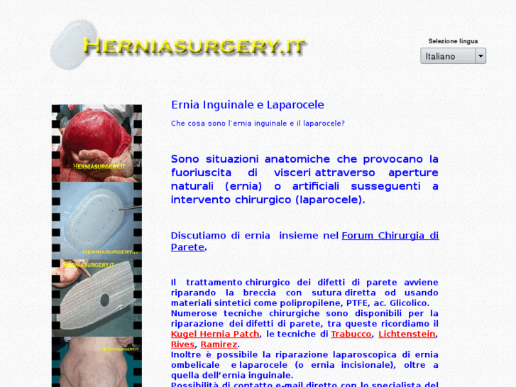 www.herniasurgery.it