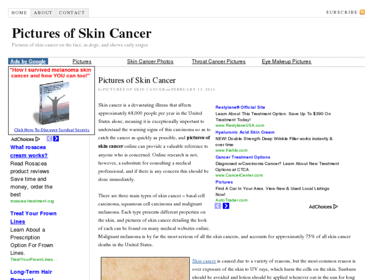 www.pictures-of-skin-cancer.com