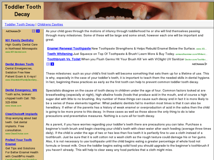 www.toddlertoothdecay.com