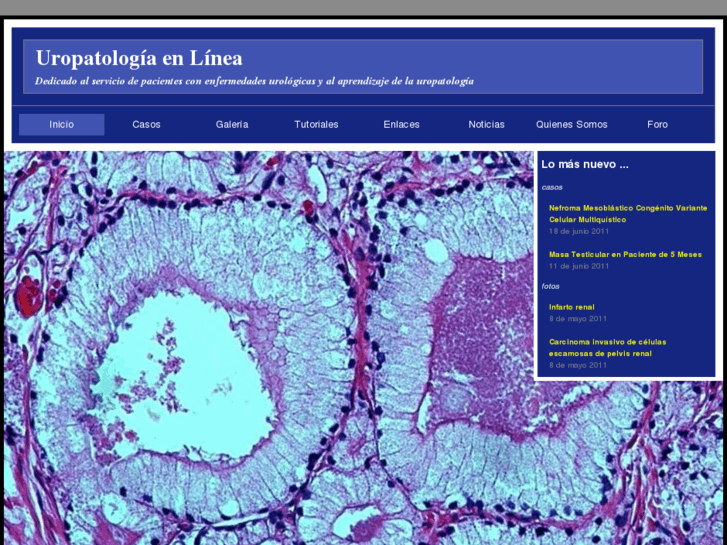 www.uropatologia.com