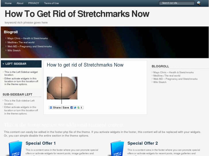 www.howtogetridofstretchmarksnow.org