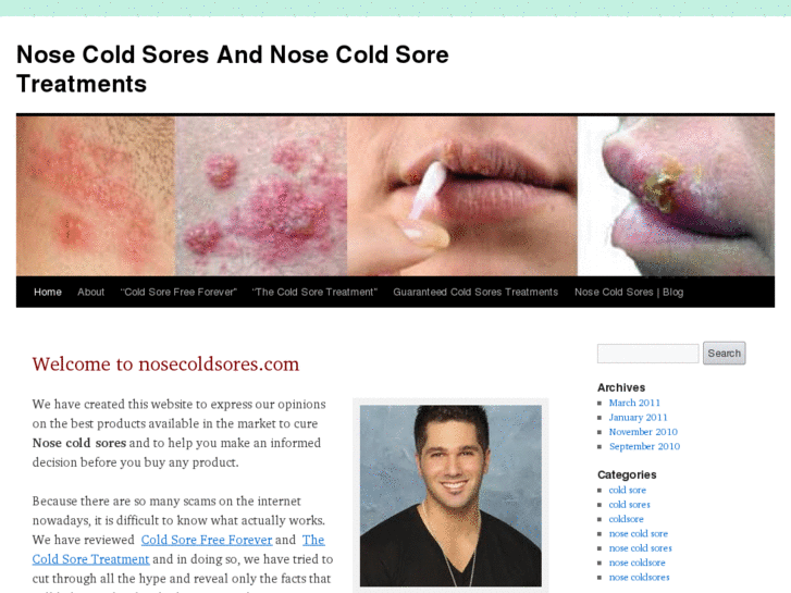 www.nosecoldsores.com