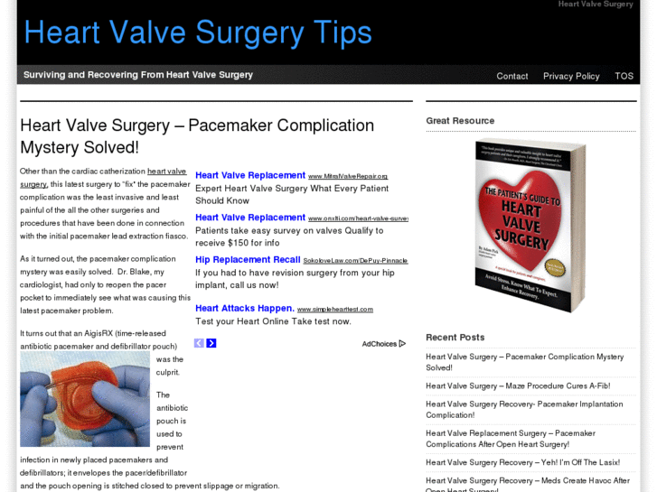 www.heart-valve-surgery.net