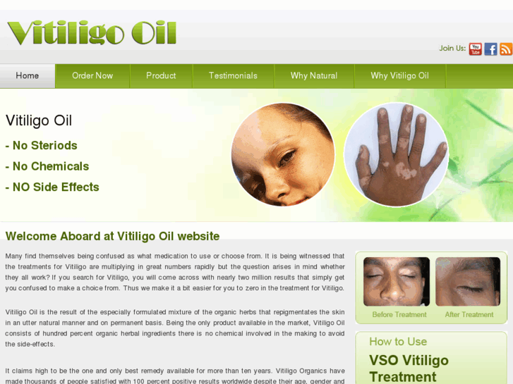 www.vitiligooil.com