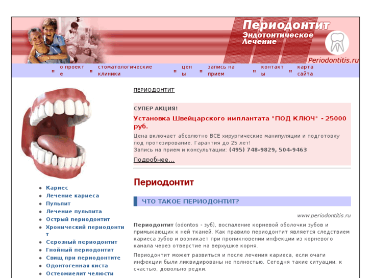 www.periodontitis.ru