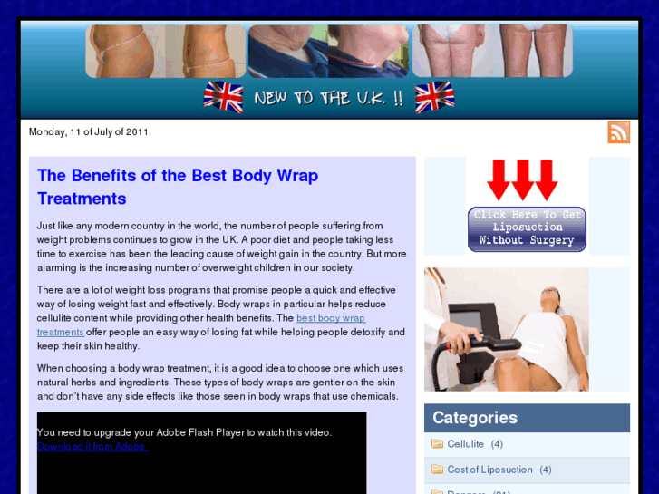 www.ukliposuctionalternative.com