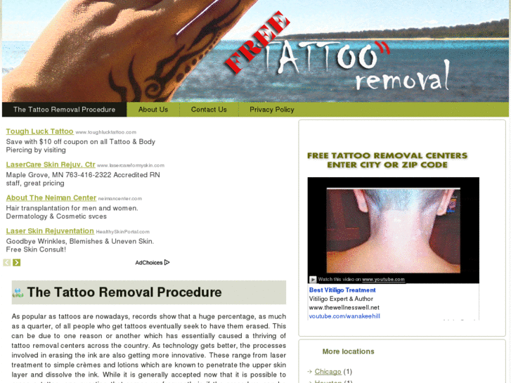 www.free-tattoo-removal-centers.com